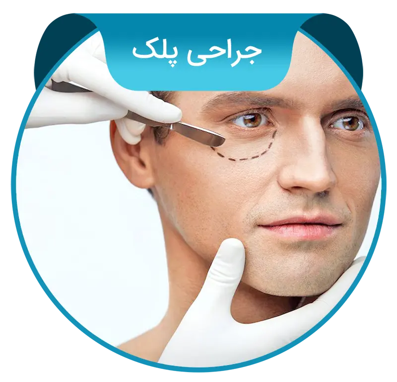 blepharoplasty-fa